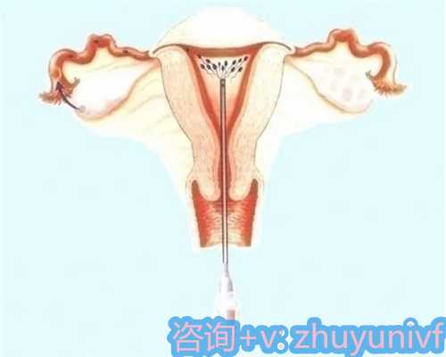 苏州供卵机构好不好进,代怀生子流程透明,操作规范