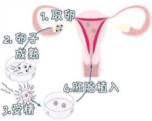 婴儿智商高低从出生便可知