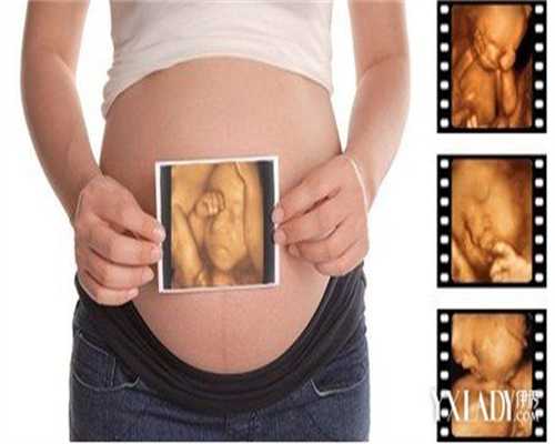 孕妇洗头的时候，要注意什么吗？洗头发的频率是不是要低一点呢？