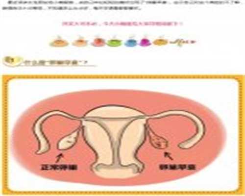 苏州第三代试管婴儿最佳选择指南