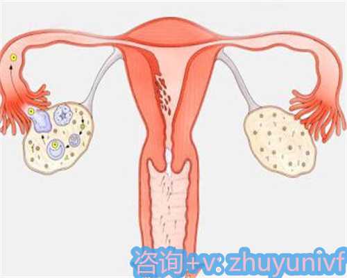 苏州找卵子找助孕,快速实现您的梦想